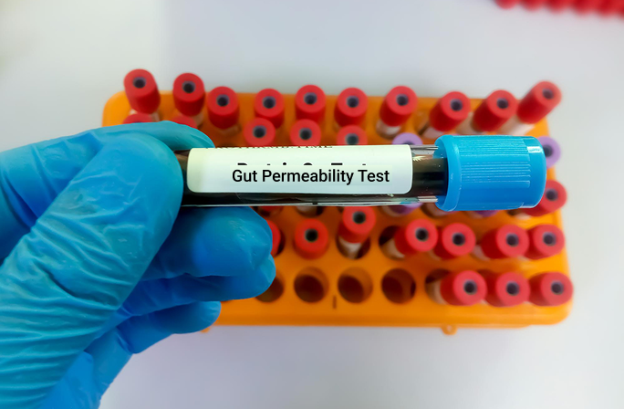 Blood sample tubes for gut permeability testing